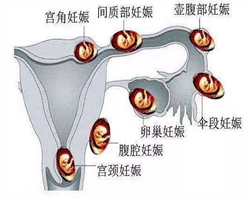 北京代孕花费~北京代孕公司怎么找~月经前三天体温变化是怎样的