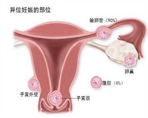 北京代孕网站`北京代怀孕过程`在家羊水破了该怎么办