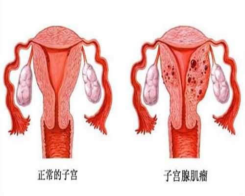 北京职业代孕`北京代母哪里有`怀孕什么补铁最好